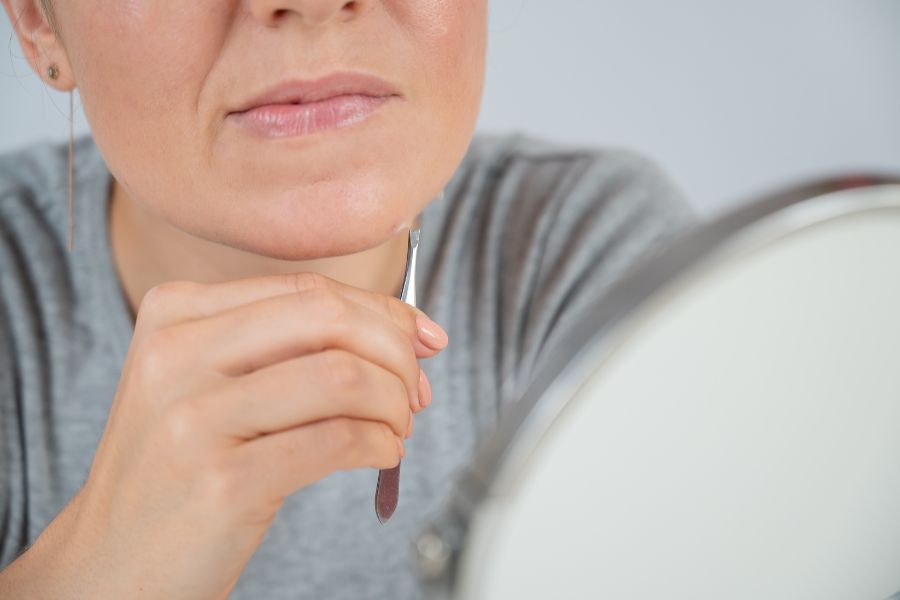 PCOS Hirsutism symptoms