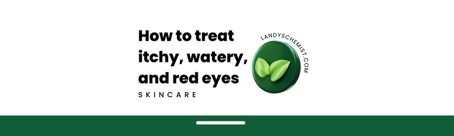 HOW TO TREAT ITCHY EYES