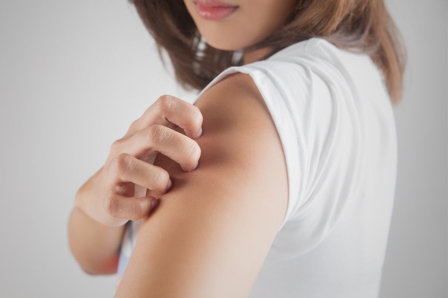 How to Alleviate Itchy Skin Menopause