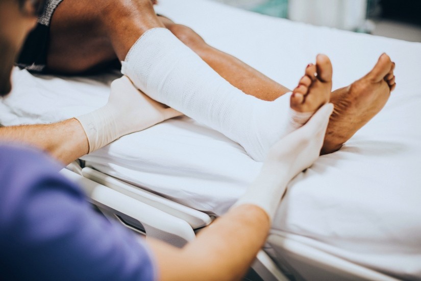 doctor holding broken leg in cast