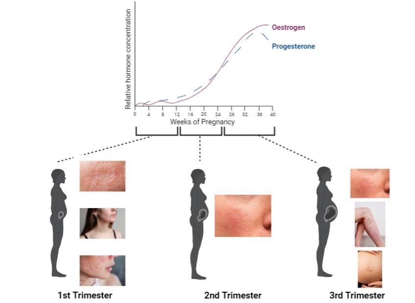 Changes during pregnancy