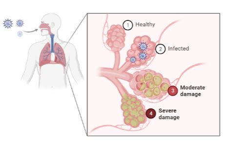 covid levels of inflammation