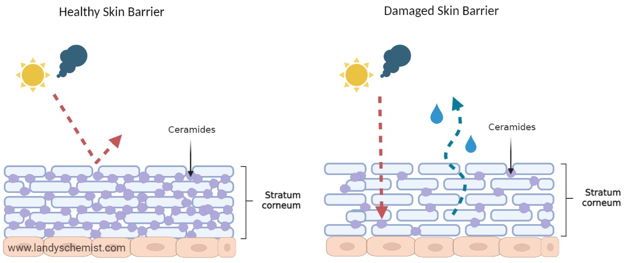 Signs your skin is producing less ceramdies