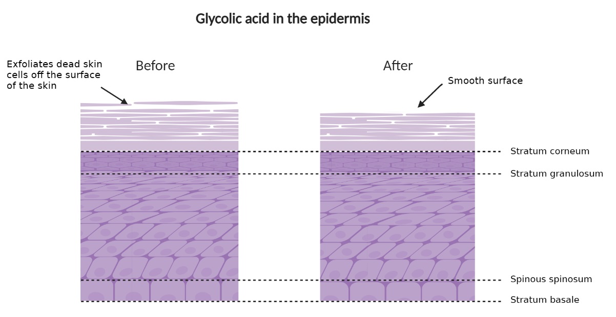 glycolic acid epidermis