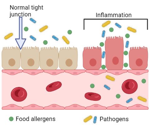 leaky gut diagram