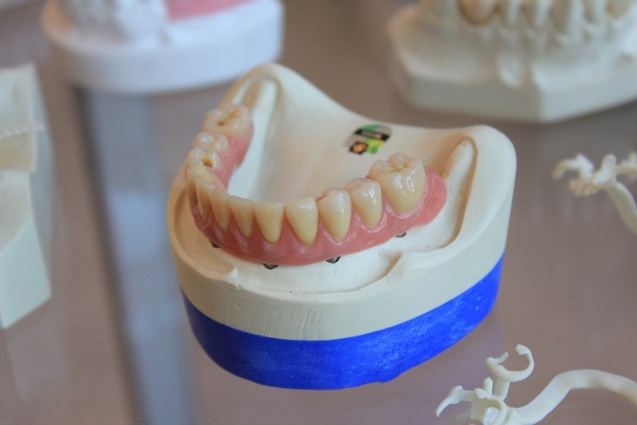 model of teeth